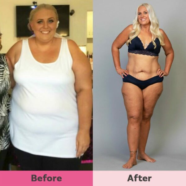 drastical weight lost